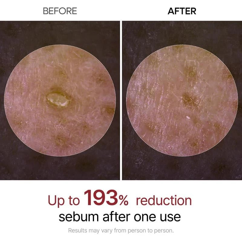 đFlash Sale⥠50K+ SOLD OUT! NĂ€stan Gone-đ„đ„Peel Shot Glow Rice Ampoule Duo